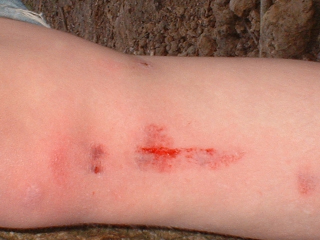 injury1.jpg